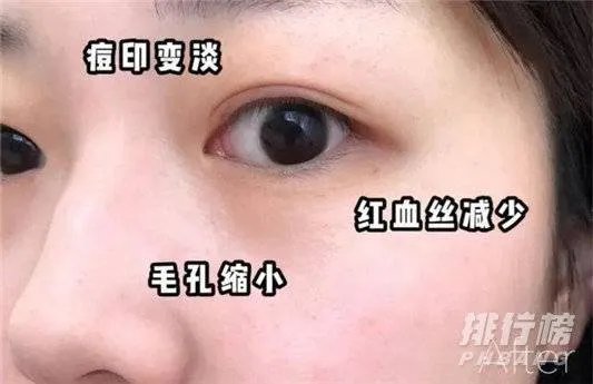 赫莲娜绿宝瓶精华新旧版本对比_赫莲娜绿宝瓶精华新旧版本区别